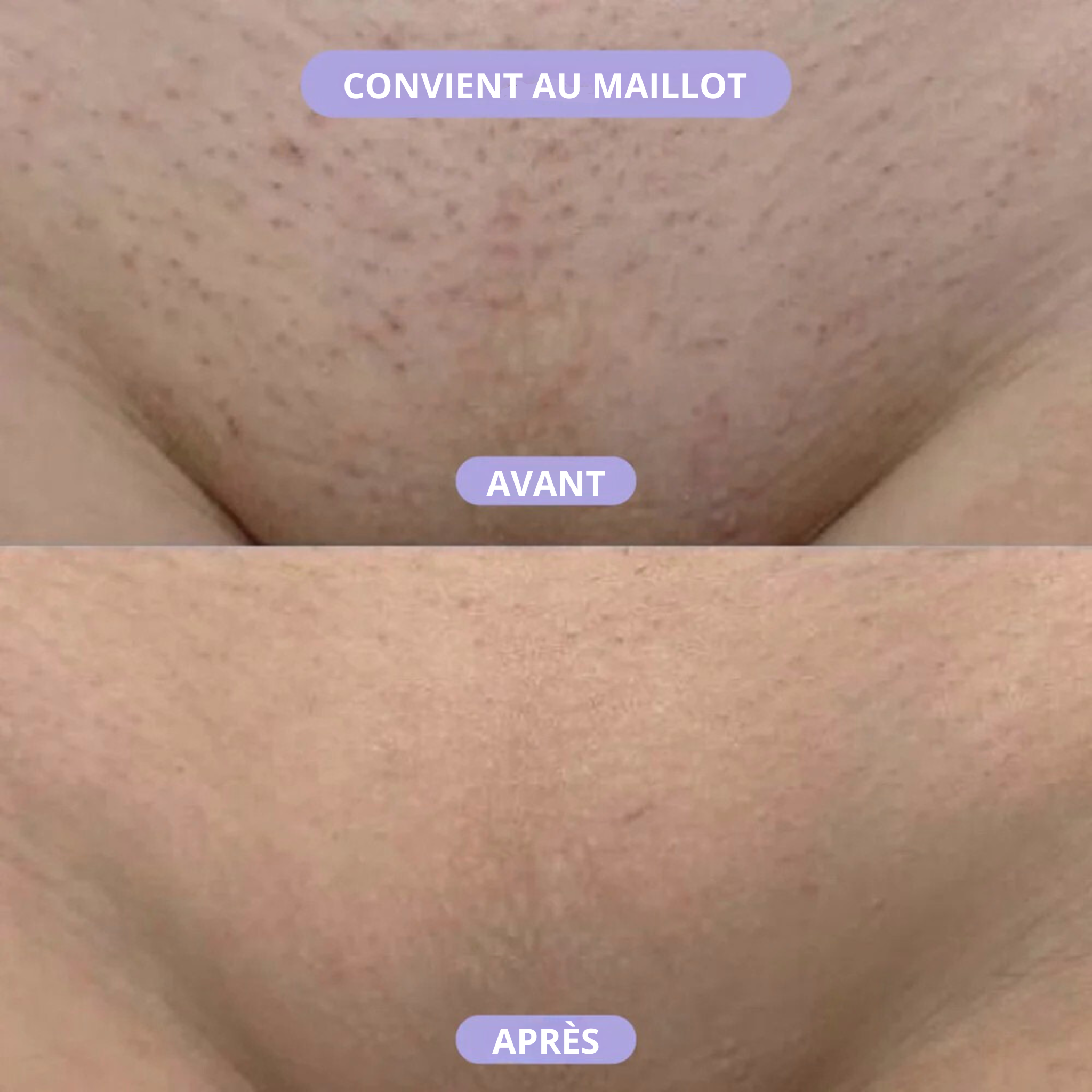 Gomme Dépilatoire Fubace